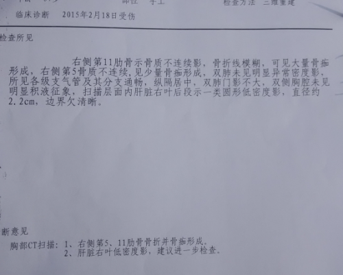 两个月做了两次CT，安全、影响与注意事项