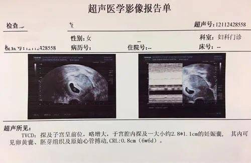 孕囊半个月没怎么长，解读与应对